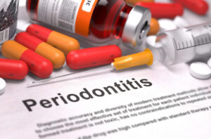 dental implants with gum disease